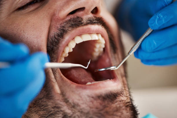 Professional Emergency Dental Service in NC