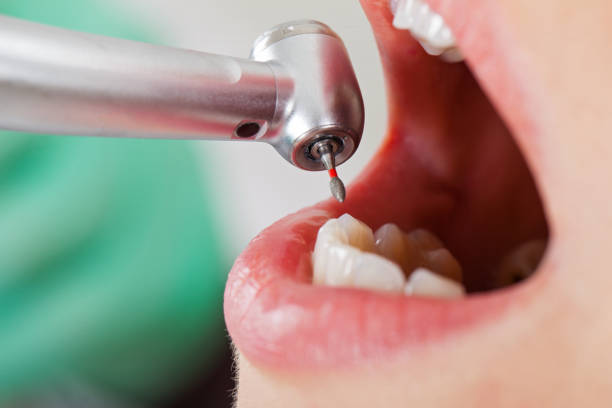 Best Dental Abscess Treatment in Wrightsville Beach, NC